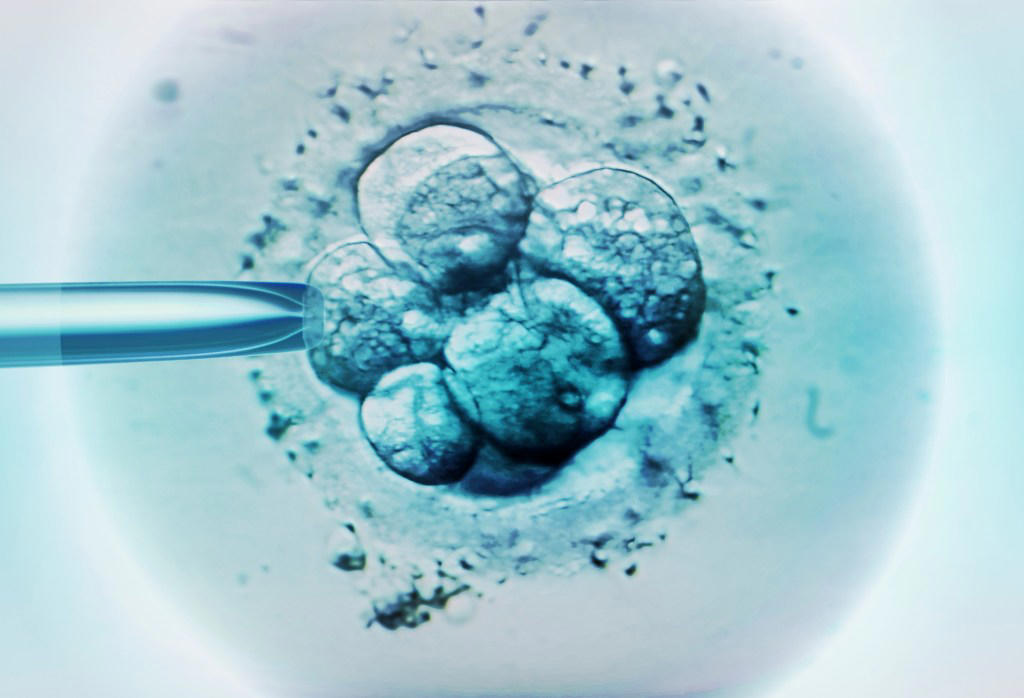 What does IVF involve?