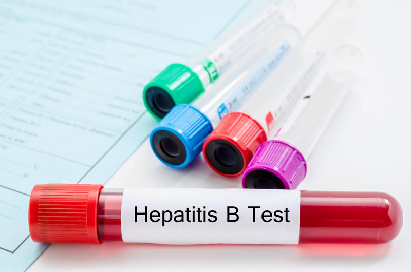 What is hepatitis?, What causes them?, What are some of the biggest misconceptions about hepatitis?, What are some signs of hepatitis?, Can hepatitis lead to serious complications if left untreated?, Can hepatitis be prevented?, Can hepatitis is treated?