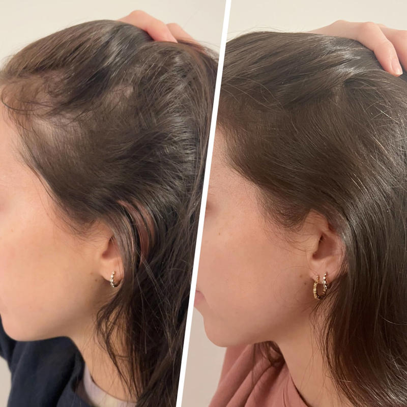 What is a hair-thickening product? , Key ingredients to look for in hair thickening products, The best hair thickening products, according to experts, The best hair-thickening products, tested by editors, What are the different types of hair-thickening products?, How to use hair-thickening products effectively, Natural and alternative methods to increase hair thickness, Frequently asked questions, How we chose, Meet the experts