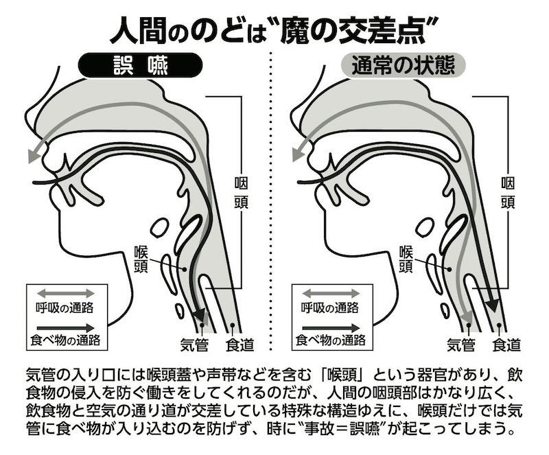 更年期以降の女性は特に注意が必要！, 人間ののどは誤嚥が起こりやすい構造, 人間ののどは“魔の交差点”, 週2〜3回の筋トレでのどの筋力はアップできる！, 誤嚥性肺炎の予防もできる！50代から始めたい「のどトレ7」, 飲み込みに使う筋肉を強化！全身のレジスタンス・トレーニング3選