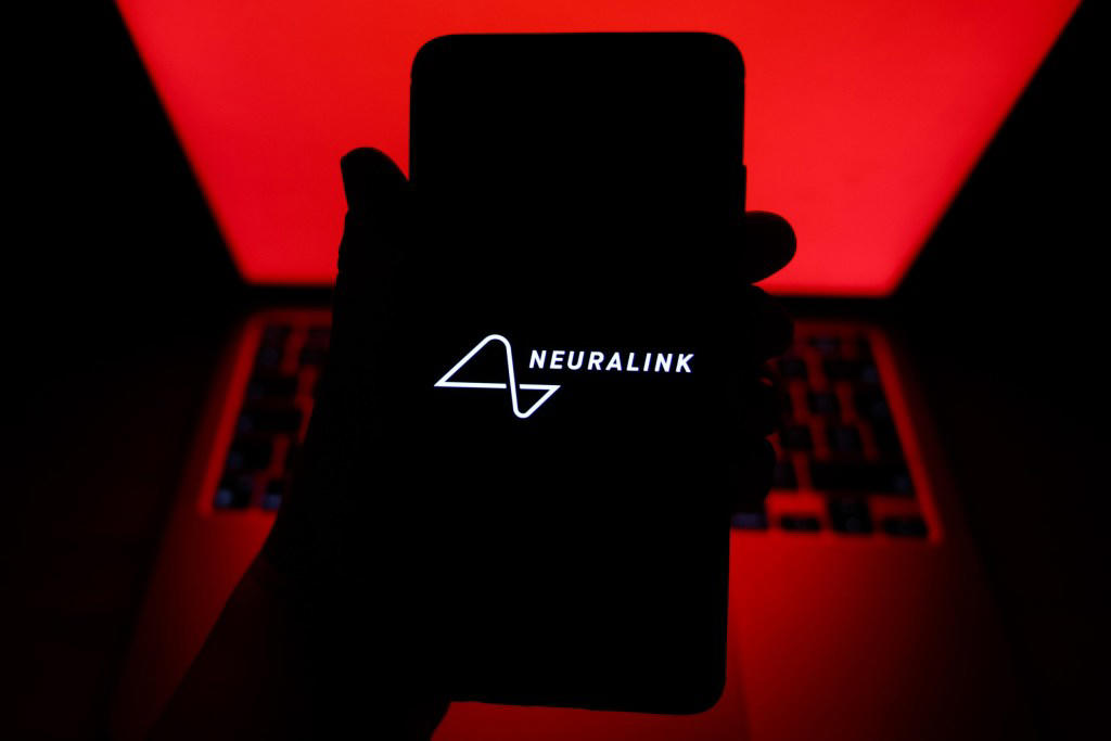 Woman reveals how Elon Musk’s Neuralink brain chip has changed her life