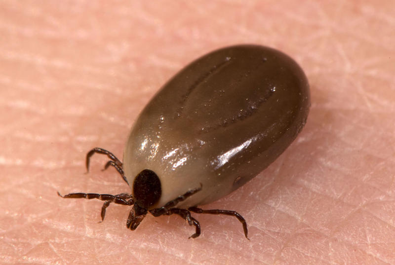 What is Lyme disease?, What are the symptoms?, How do you contract Lyme’s disease?, What should you do?