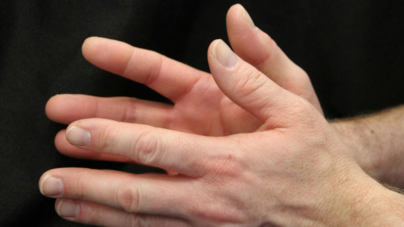 1. Muscle Cramps That Won’t Quit, 2. Tingling Or Numbness in Your Fingers, 3. Brittle Nails Breaking Without Warning, 4. Frequent Bone Fractures Or Weakness, 5. Dental Problems Like Loose Teeth, 6. Unexplained Fatigue And Sluggishness, 7. Irregular Heartbeat Or Palpitations, 8. Difficulty Swallowing Or Throat Spasms, 9. Seizures Or Sudden Jerking Movements, 10. Mood Swings Or Anxiety For No Reason, 1. Eat More Leafy Greens, 2. Add Chia Seeds To Your Smoothie, 3. Snack On Dried Figs Or Apricots, 4. Soak Up Vitamin D Through Daily Sun Exposure, 5. Choose Fortified Plant Milks, 6. Sprinkle Sesame Seeds On Your Meals, 7. Cook With Bok Choy Or Chinese Cabbage, 8. Sip Bone Broth, 9. Embrace Fermented Soy Foods Like Natto, 10. Go For Sardines With Edible Bones