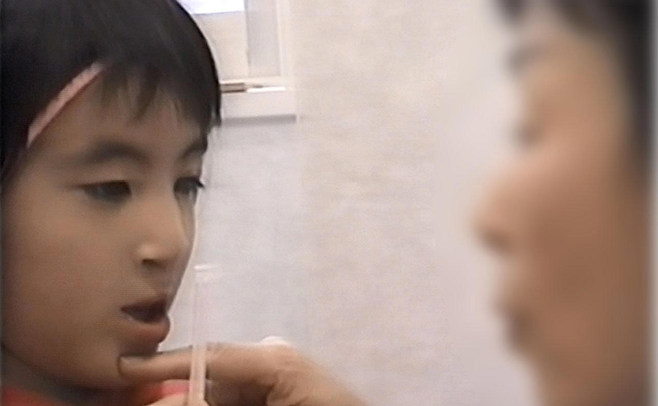 どこが鼻でどこが唇なのかわからない状態で生まれ, 病院の待合室で見た本「私、この病気なん？」, 生後3か月で唇を閉じる手術を受けた, 小学4年生で後頭部に円形脱毛症ができ