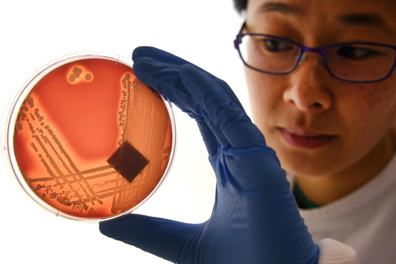 既存の薬剤が効かないスーパーバグ, 「超多剤耐性菌」とは, 2025年までに3,900万人が死亡, 医療支援の削減でさらに悪化, 負担は全世界で年間2兆ドル弱, 薬剤耐性菌の治療にかかる費用が増加, スーパーバグ対策への投資拡大, 政策変更や新薬の開発, ありふれた感染症が致命的になるおそれ