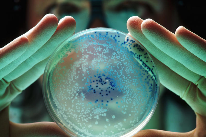 既存の薬剤が効かないスーパーバグ, 「超多剤耐性菌」とは, 2025年までに3,900万人が死亡, 医療支援の削減でさらに悪化, 負担は全世界で年間2兆ドル弱, 薬剤耐性菌の治療にかかる費用が増加, スーパーバグ対策への投資拡大, 政策変更や新薬の開発, ありふれた感染症が致命的になるおそれ