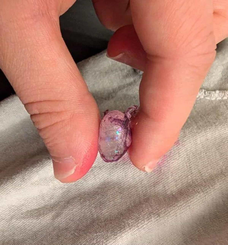 'What are the little cups beside this bar sink?', 'Small metal thing found while gardening, quite heavy, 2411 on the end.', 'Found in laundry. Clear sparkly bean-like thing stained my clothes pink.', 'Weird stools found at the curb in an old industrial area.', 'Lead STA-TITE with rubber band, about 4oz.'