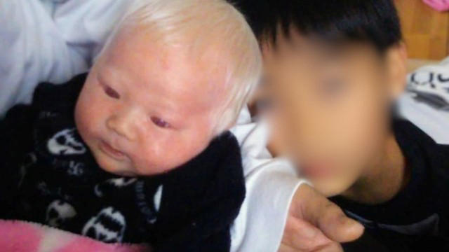 出産日に我が子が「アルビノ」であると分かって…, 当事者会で“リアルなアルビノ当事者の姿“を見たことが転機に, アルビノの息子を持つ家族が心がけている対策とは？, 「アルビノ」という区分で福祉支援が受けられない当事者のもどかしさ