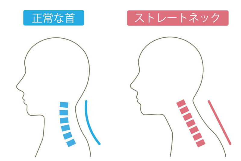 太もも裏が硬いと首こりが改善しない理由, 太もも裏をほぐすことで得られる効果, もも裏ストレッチのやり方, 効果を出すポイント