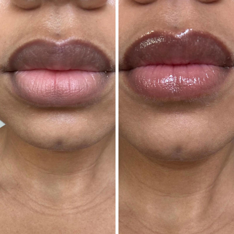 How I picked the best lip serums, How we tested lip serums, Best lip serums, What’s the difference between a lip balm and a lip serum?, Meet our experts, Why trust NBC Select?