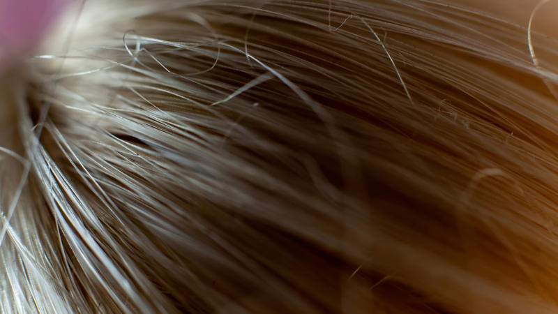 3. It Doesn't Actually Clean Your Hair 1. It Saves You a Lot of Time, 2. It Adds Instant Volume, 3. It Extends the Life of Your Blowout, 4. It's Great for Post-Workout Hair, 5. It Reduces Heat Damage, 6. It's Travel-Friendly, 7. It Helps Preserve Color-Treated Hair, 8. It Works on Multiple Hair Types, 9. It Can Double as a Styling Product, 10. It's Budget-Friendly, 1. It Can Cause Product Buildup, 2. It May Irritate a Sensitive Scalp, 3. It Doesn't Actually Clean Your Hair, 4. It Can Leave a White or Gray Residue, 5. It Can Weigh Hair Down Over Time, 6. Overuse May Contribute to Hair Loss, 7. Aerosol Formula Raises Health and Environmental Concerns, 8. It Doesn't Work the Same on All Hair Types, 9. It Can Cause or Worsen Dandruff, 10. Fragrance Can Be Overpowering