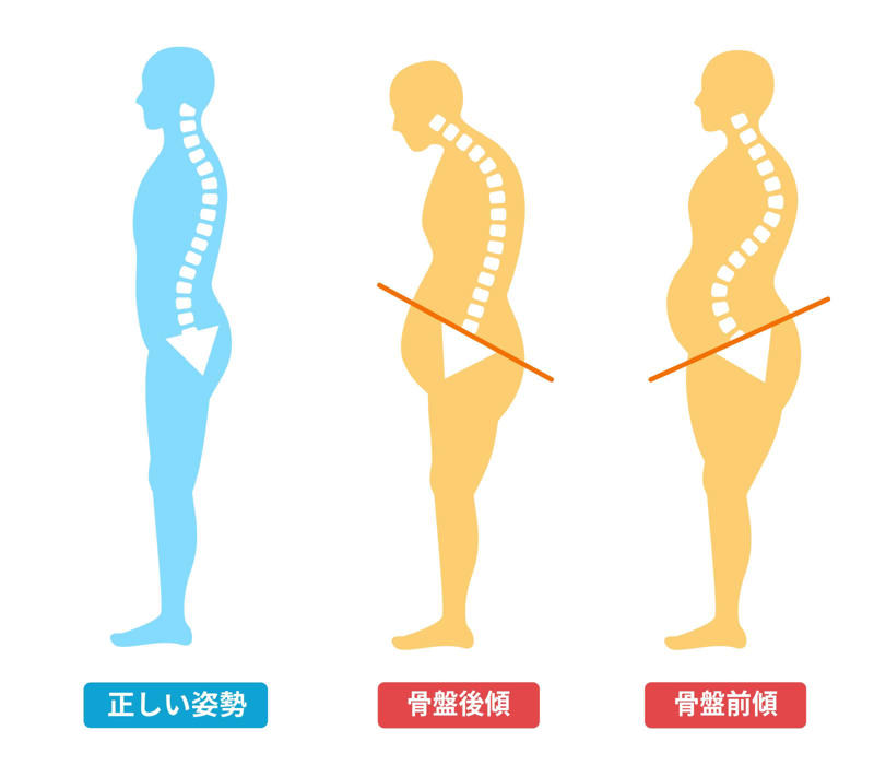 スクワットで脚が太くなる原因は「骨盤後傾」, 骨盤を正しく前傾させると下半身が引き締まる, お尻に効く「股関節スクワット」とは, 股関節スクワットのやり方, 効果を高めるためのポイント