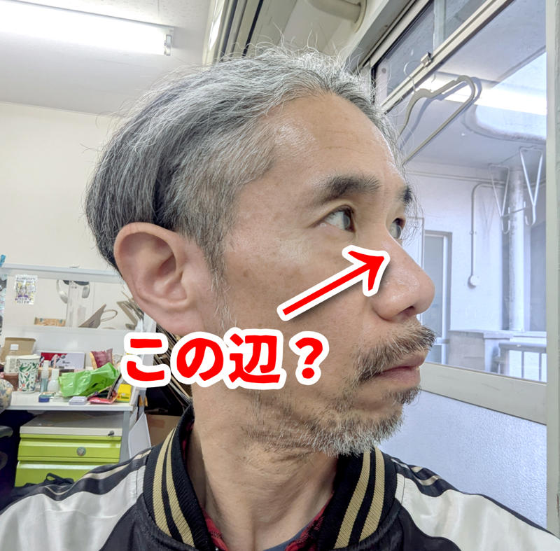 ・ライバルとのケンカ説, ・顔から転んだ説, ・ボールが当たった説, ・猫に引っかかれた説, ・もしかして「サビオか」？