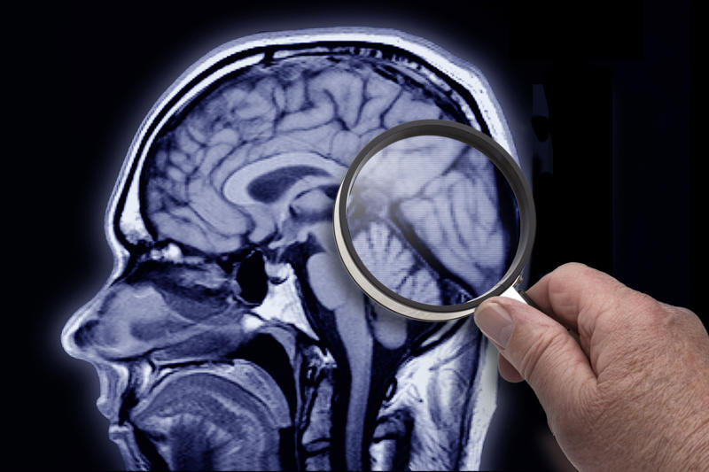 A 19 year-old with Alzheimer's? What happens to our soul after we die?, A question many have tried to answer, What is a soul, Our essence, The soul or consciousness, A new theory about the soul, The 'Orch-OR' theory, Consciousness arises within the nerons, Roger Penrose, Nobel Prize in Physics in 2020, Friend of Stephen Hawking, Stuart Hameroff, A theory that needs to be tested, Which supports the 'Orch-OR' theory, Do the principles of Quantum mechanics affect our brain?, A biological approach, A Quantum approach, Consciousness is a vibrating wave, The brain as a quantum computer, Superposition of states as a measurement of consciousness, Everett's Many-Worlds Interpretation, The choice not made, We are the reality, A new way to understand the brain, What happens inside the neuron?, So is the soul immortal?, Information is saved, An intriguing but unproven theory