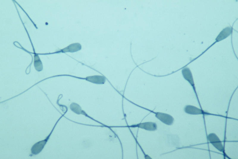 Average sperm count fell by 52% Bigger isn't better, A 24% size increase, Data from 55,761 men, A substantial increase in size, From 4.8 inches to 6 inches, "Any overall change in development is concerning", A fast change is concerning, Surprising results, Chemicals are to blame, Endocrine-disrupting chemicals in our environment and food, The hormonal milieu is affected, Chemical exposure affects puberty, Sperm counts affected, A significant decline in sperm counts between 2014 and 2020, Average sperm count fell by 52%, An acceleration in sperm count decline, Some think the male member is shrinking, Is pollution causing shrinkage?, Hopefully more studies will clarify things