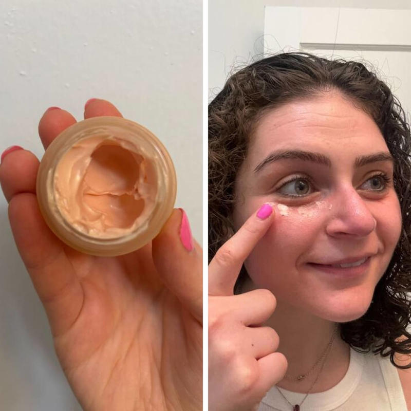 What is the best treatment to get rid of dark circles?, How I picked the best dark circles treatments, Best products for treating dark under-eye circles, Best eye creams for dark circles, Best eye masks and patches for dark circles, More treatments to help reduce dark circles, Meet our experts, Why trust NBC Select?