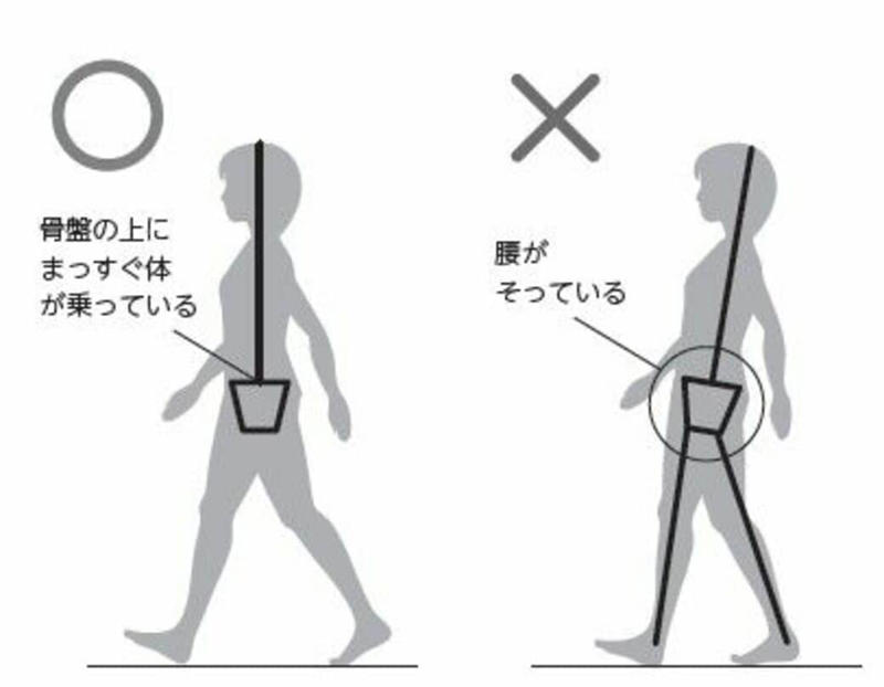 つま先型は……足の指・足首の関節が硬い, ひざ痛型は……ひざ関節と股関節が硬い, 腰痛型は……骨盤がゆがんでいる, 猫背型は……背骨が硬い, 肩こり型は……肩の関節が硬い