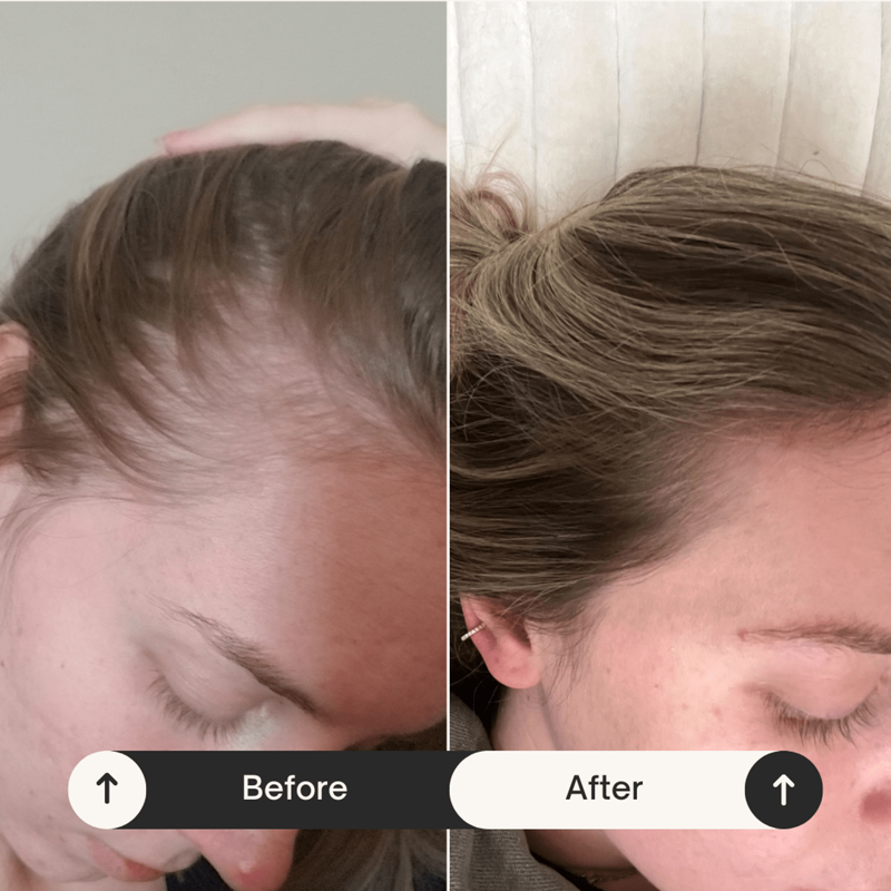 How we picked the best thinning hair shampoos and treatments, The best treatments and shampoos for thinning hair, How to treat thinning hair, What causes thinning hair?, How to prevent hair loss, Frequently asked questions, Meet the experts, Why trust NBC Select?