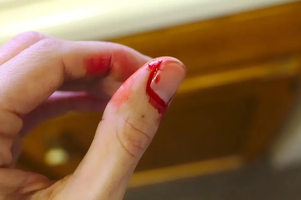 Beritahu Pengawas Jika Kamu Sedang Menstruasi, Terluka atau Hamil, 1. Rencanakan Perjalanan, 2. Bawa Bekal Sendiri, 3. Jangan Bawa Daging , 4. Beritahu Pengawas Jika Kamu Sedang Menstruasi, Terluka atau Hamil, 5. Kenakan Pakaian yang Praktis, 6. Mitos Jangan Mengenakan Pakaian Berwarna Merah, 7. Jangan Melakukan Gerakan Berlebihan, 8. Menghindar dari Kejaran Komodo, 9. Jaga Jarak Aman, 10. Gunakan Tabir Surya