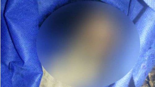 Mahasiswi S2 Makassar Aborsi Kandungan Hasil Hubungan Gelap, Janin Dikubur di Rumah Pacar