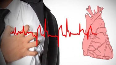 Sering Deg-degan Tanpa Sebab? Ini Cara Bedakan Jantung Berdebar Normal dan Gejala Aritmia