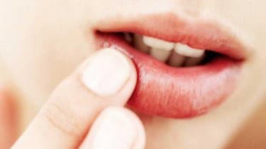 Bibir Kering saat Puasa Bikin Tidak Nyaman, Begini 9 Cara Mengatasinya
