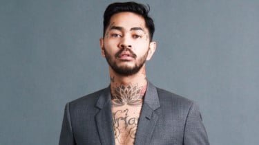 Onadio Leonardo Dinyatakan Sehat, Terungkap Kondisi Terkininya