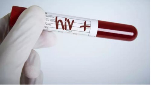 Miris! Sekitar 2.700 Remaja Usia 15&ndash;19 Tahun di Indonesia Terinfeksi HIV