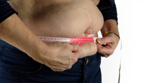 Gaya Hidup Tak Sehat dan Stres Bisa Picu Obesitas, Ini Cara Mencegahnya