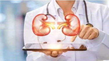 Dokter Ungkap Penyebab Gagal Ginjal yang Kini Banyak Menyerang Usia Muda
