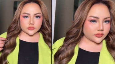 Tes DNA Tak Cocok dengan Ridwan Kamil, Lisa Mariana Pertimbangkan Second Opinion