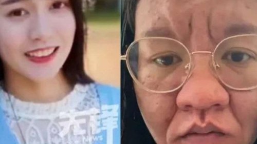 Seperti Beda Orang, Wanita Ini Mengalami Transformasi Fisik yang Mengejutkan Selama Kehamilan