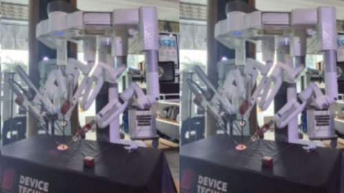 Canggih! Teknologi Bedah Robotic dari AS Kini Hadir di Indonesia