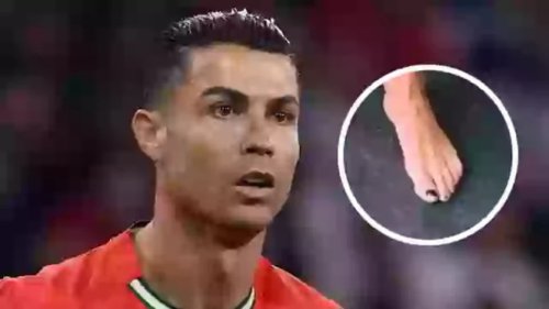 Rahasia di Balik Kuku Kaki Hitam Cristiano Ronaldo, Ternyata...
