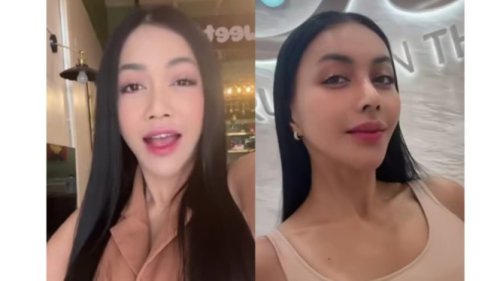Ungkap Alasan Jalani Operasi Hidung, Denada: Gak Ada Sinus, 100 Persen untuk Estetik