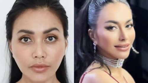 Tuai Pro Kontra Usai Putuskan Operasi Hidung, Denada Santuy: Aku Happy dengan Hasilnya