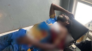 Aksi Gila KKB Aibon Kogoya! Warga Dihujani Peluru di Jalan, 1 Tewas, 4 Terluka