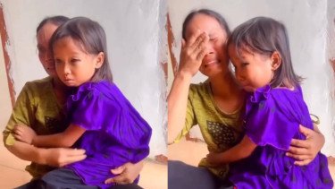 Miris! Siswi SD Pulang Sekolah dengan Mata Lebam dan Pembuluh Darah Pecah, Guru Ancam agar Tak Melapor