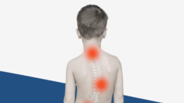 Top 5+ Tanda Awal Skoliosis yang Sering Disepelekan Banyak Orang