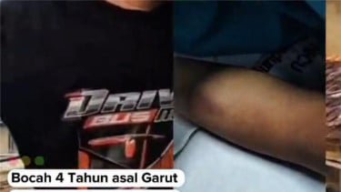 Balita Asal Garut Meninggal Diduga Dianiaya Ibu Sambung, Begini Kata Polisi