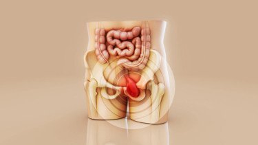 Takut Anak Mandul karena Operasi Hernia? Begini Kata Dokter