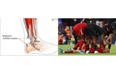 Hugo Ekitike dipastikan absen hingga 9 bulan akibat robek tendon achilles