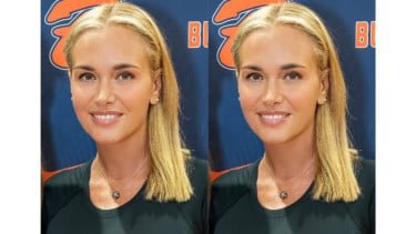 Vanessa Trump Ungkap Idap Kanker Payudara di Usia 48 Tahun