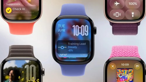 Top 5+ Fitur Baru Apple Watch Series 11 yang Bakal Menggemparkan Pasar Teknologi!