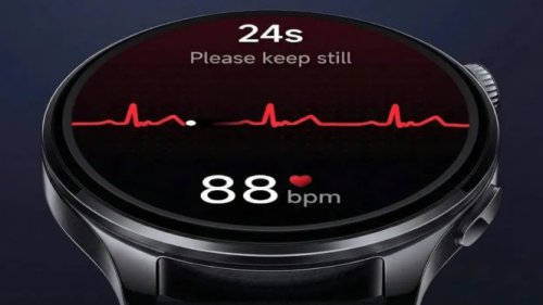 Xiaomi Watch 5 Bocor: Sensor EMG Baru, Revolusi Kebugaran di Pergelangan Tangan!