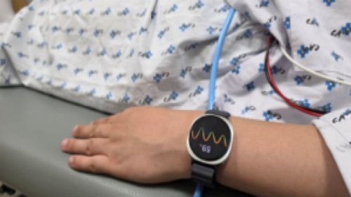 Samsung Galaxy Watch6 Bisa Prediksi Pingsan Sebelum Terjadi