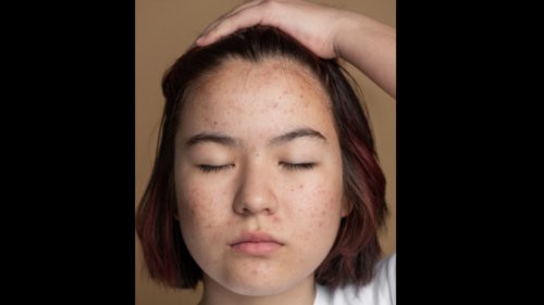 1. Sarung Bantal Jarang Diganti, 2. Cuci Muka Terlalu Sering, 3. Salah Pilih Sunscreen, 4. Tangan Sering Menyentuh Wajah, 5. Rambut Berminyak Menyentuh Kulit, 6. Handuk Wajah yang Nggak Bersih, 7. Terlalu Sering Ganti Skincare, Tips Mencegah Beruntusan Tanpa Obat, Top 7+ Kebiasaan Sepele yang Diam-diam Bikin Wajahmu Beruntusan!