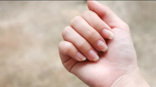 Sering Ada Bintik Putih di Kuku? Mungkin Tubuh Sedang Kasih Sinyal Bahaya!