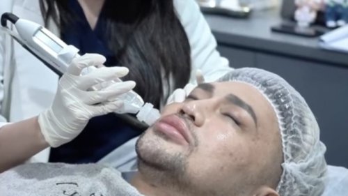 Apa Itu Collaglow Prime? Treatment Baru yang Bikin Wajah Glowing Kayak Selebriti