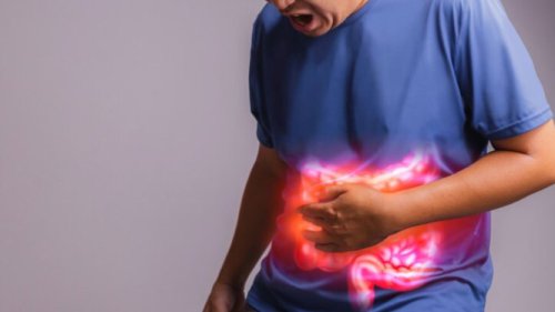 Jangan Sepelekan IBD! Kenali Gejala, Risiko, dan Cara Mencegah Supaya Tidak Terjadi Komplikasi Serius